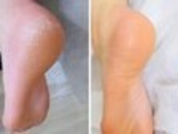 リゼラアンドコー 天童・PONO/ドイツ式フットケア専門店