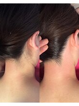 キエズ(KIES)/もみあげワックス脱毛