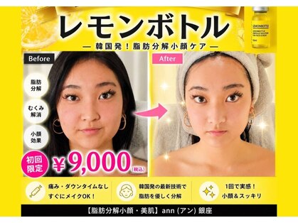 アン 銀座(ann)の写真