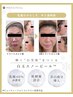 【新規】人気No. 2 透明感のある白玉肌へ♪白玉ピール￥14,300→