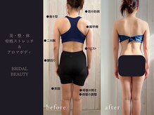 オーヴォ リビングスパ(OVO living spa)/６ヶ月間で４回ご利用時の変化例