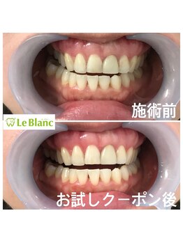 ルブラン 奈良店(Le Blanc)/お得なフリーパスコース！