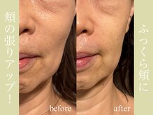 健志接骨院/BeforeAfter