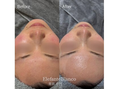 エレファンテブランコ(Elefante Blanco)の写真