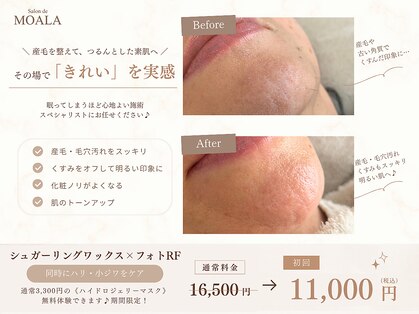 サロンドモアラ(Salon de MOALA)の写真