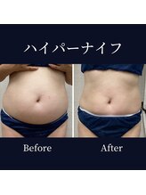 ハリルル 併設 GLケンタ鍼灸整骨院(HARILULU)/サマーキャンペーン中