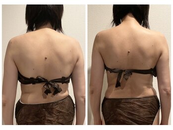 クレビア(CRE'BIA)/猫背