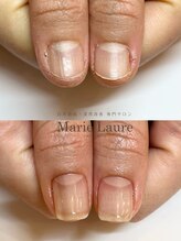 マリーロール 梅田店(Marie Laure)/深爪矯正/自爪育成/自爪風