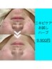 【ハーブ＆ヒト幹】剥離なしハーブピーリング＋ヒト幹100％導入＋パック