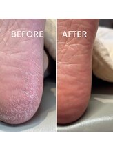 サロン エフ(salon f)/足裏角質ケア