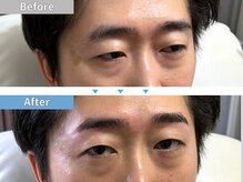 マユクリア 埼玉大宮店/美眉B/A [眉毛/眉毛サロン/大宮]