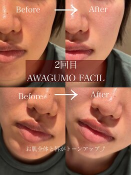 サロン エフ(salon f)/【泡雲フェイシャル】