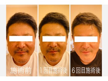 モアビューティー 紙屋町店/【男性も大歓迎◎】