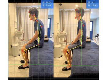 レスト(Rest)/悩んでいた姿勢を改善◎肩こり◎