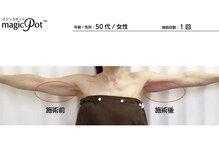 クリニカルホワイトケア 和泉府中店(クリニカルWHITEケア)/痩身 二の腕