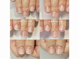 爪育ネイルケア