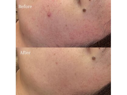 ベリスユイット(BELLIS HUIT)の写真