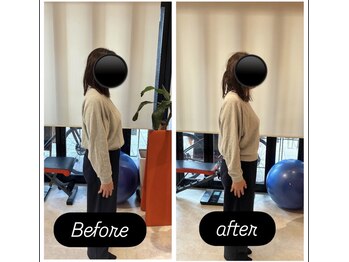 カワル整体 上通り院/姿勢改善