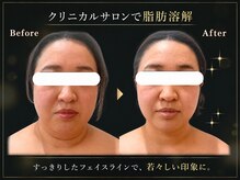 リオ(Rio)の雰囲気（業界最濃度脂肪減少剤使用◎引き締め効果バッチリ【滋賀/草津】）