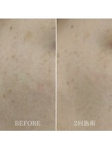 エムスリー(m3)/肌がぐんぐん変わっていく！