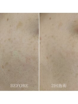 エムスリー(m3)/肌がぐんぐん変わっていく！