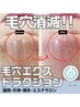 【¥16,500→¥4,990】★写真掲載可能な方限定★毛穴エクストラクション！！