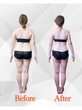 ビジュクイーン(BIJOU QUEEN)/１０キロのダイエットに成功