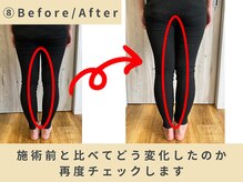 スロース鍼灸整体院(SLOTH鍼灸整体院)/目で見てわかる施術変化