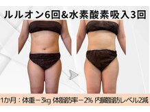 ヨサパーク ラ ぺ(YOSAPARK La paix)/1か月でこんなにも変化！