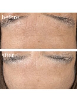 ニューバーバー キローゼ(NEW BARBER Ki.ROSE)/ゾンビマスク