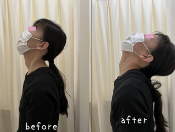 ベッラポストゥーラ(Bella Postura)/施術後の変化