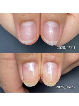 ココ(COCO)/ハンドケア・自爪育成・深爪育成