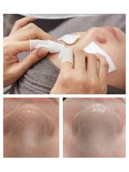 リジュベ(Rejuve)の写真/お肌の新常識★【人気No.1】毛穴エクストラクション/黒ずみ/角栓詰まり徹底ケア/理想の美肌へ¥8800☆