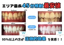 ホワイトニングショップ 三島店(WHITENING SHOP)