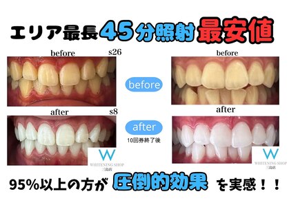ホワイトニングショップ 三島店(WHITENING SHOP)の写真