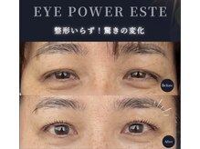 ヴィライズ 船橋(VIRISE)/【アイパワーエステ】船橋/千葉