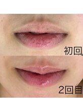 サロンドジェシカ(salon de Jessica)/プラズマ  唇ケア