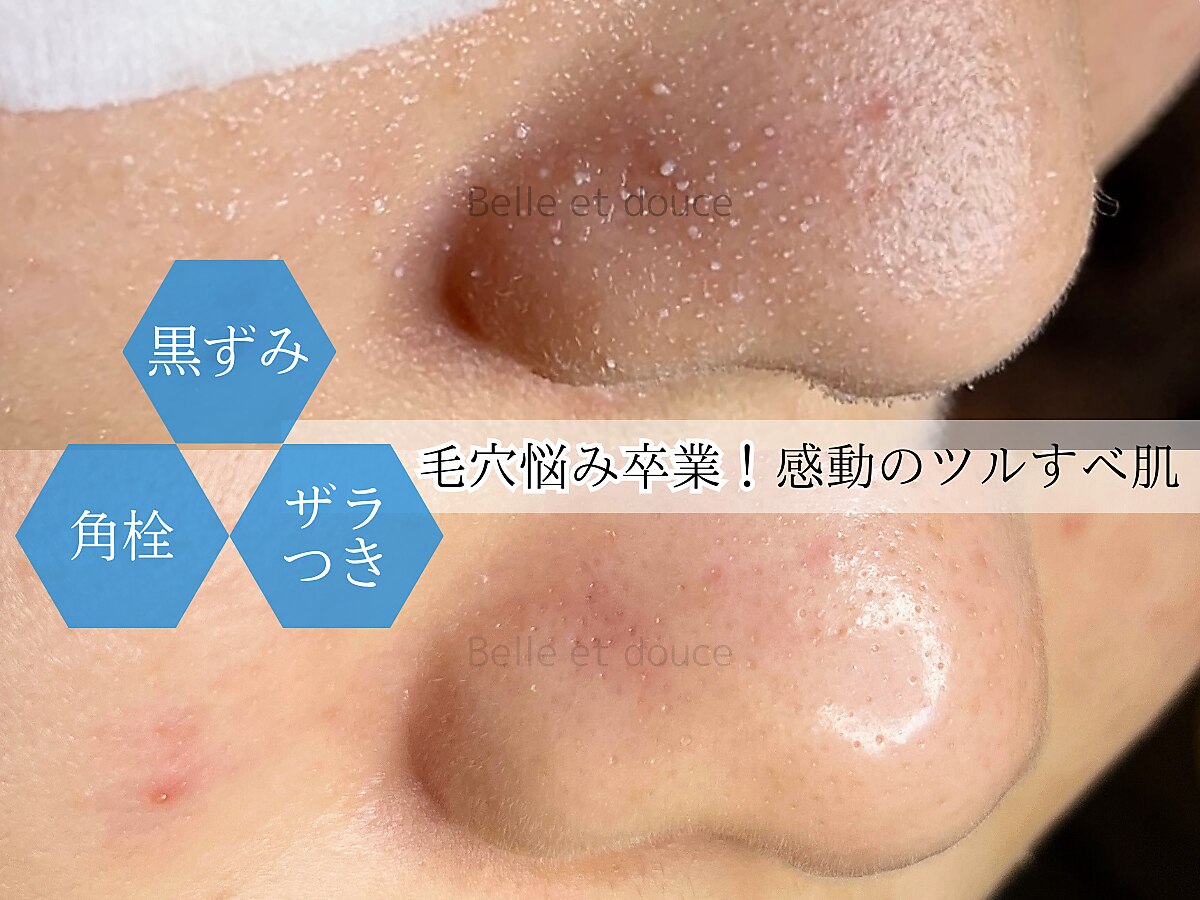 ベルエドゥース(Belle et Douce)｜ホットペッパービューティー