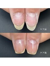 ココ(COCO)/ハンドケア・自爪育成・深爪育成