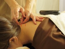 あろまはりきゅう 神楽坂/首・肩こりの解消に！