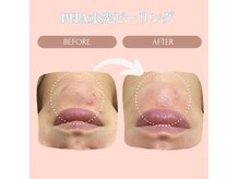 ル ルポ(Le repos)の雰囲気(最先端の“セラピックコスメ”で水光肌にチェンジ!)