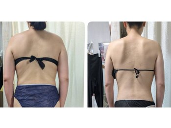 リラ(LiLas)/別人級!!!の痩身技!!!