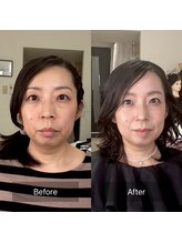 ハッピーアリスター(HAPPY ALISTER)/スペシャル診断ビフォーアフター