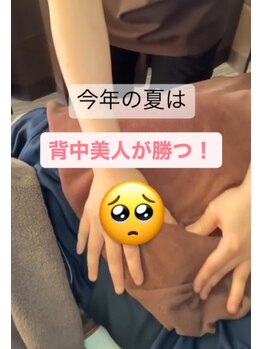 ツボミ(tubomi)/背中美人は強い！