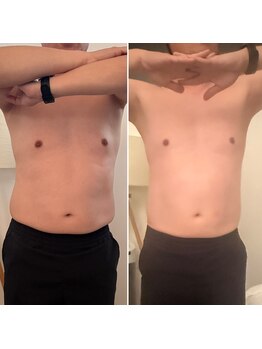 サロンドプレマージュ(Salon de Premage)/脂肪冷却&ラフォスプレミアム