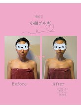 蓮(HASU)/小顔コルギ