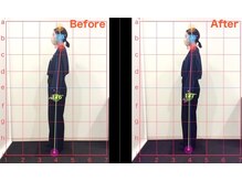 ケアハウス 戸塚(CARE HOUSE)/施術効果写真☆（before after）