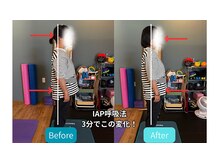 整体や呟熙/IAP呼吸法で姿勢改善