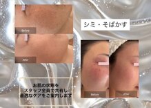 ティーズキッス(T’s Kiss)