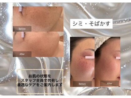 ティーズキッス(T’s Kiss)の写真